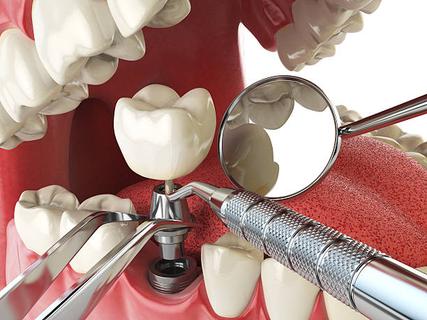 Best Emergency Dental Extractions in Jemison, AL